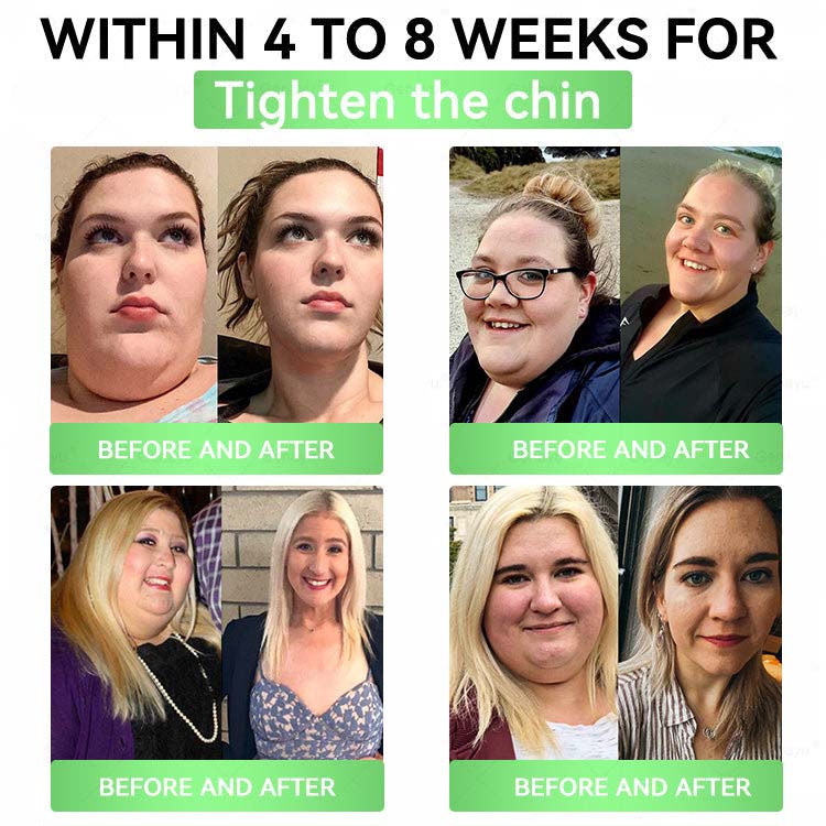 🔥Alcuras® Moringa × Berberine × AMPK 8-Benefit Slimming & Metabolic Nano Microneedle Patch 🇺🇸  Just once a day · Visible changes in 7 days  ✅ For obesity, loose skin, diabetes, sleep apnea, joint issues, and more
