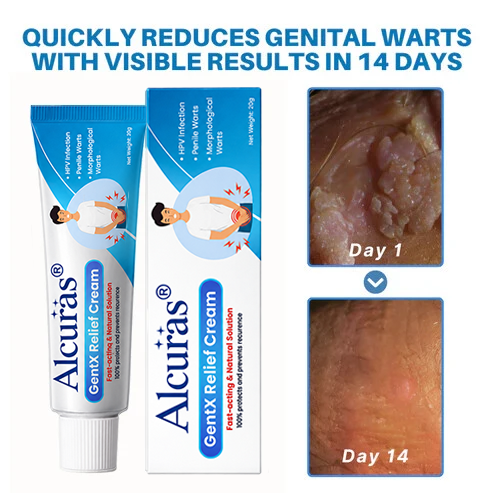 Alcuras® HPV Genital Warts Relief Cream
